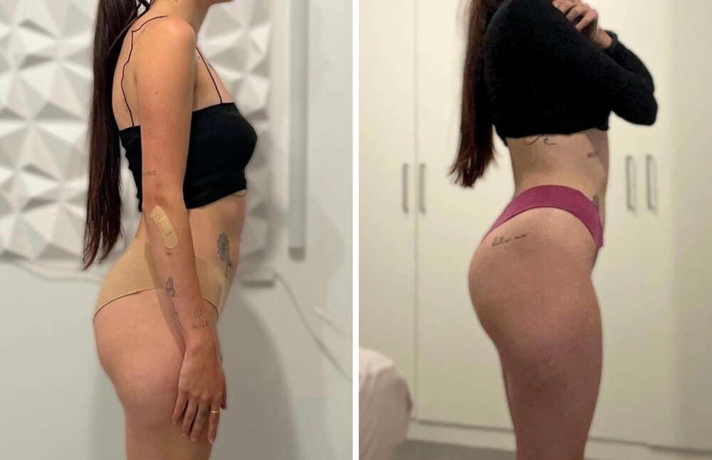 Transformación de Julia R.